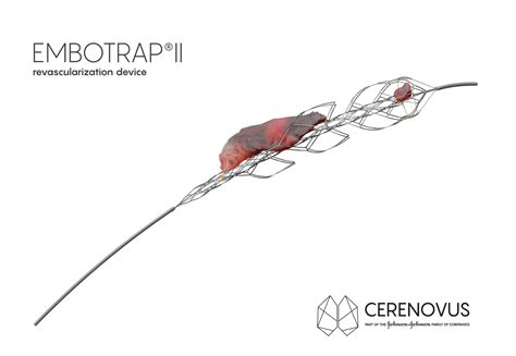 CERENOVUS RECEIVES FDA CLEARANCE FOR NEXT GENERATION STENT RETRIEVER ...