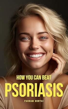 How You Can Beat Psoriasis: Quick Practical Remedies That Work eBook ...