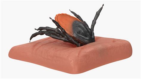 3D Tick Stuck in Skin model | 3D Molier International