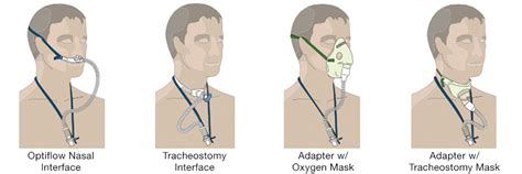 Image result for Airvo 2 FiO2