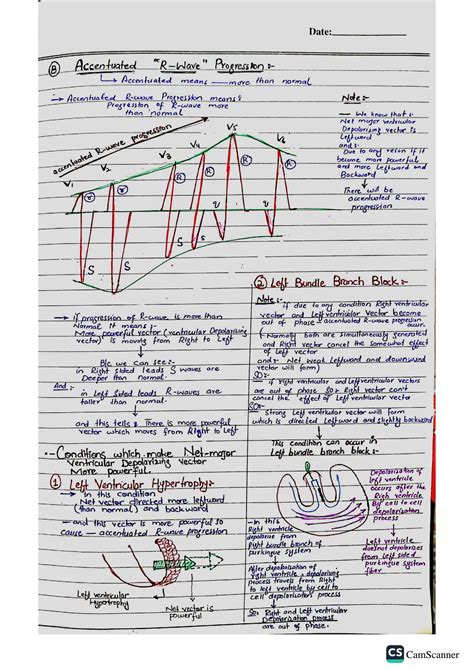 SOLUTION: Ecg chest leads abnormalities and R wave progression by dr ...
