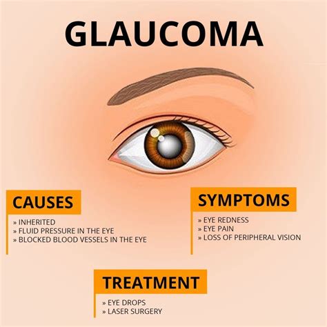 Best Glaucoma Treatment in Dubai | Eye Consultants