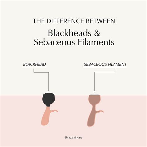Sebaceous Filaments vs Blackheads | Saya Skincare | Saya®