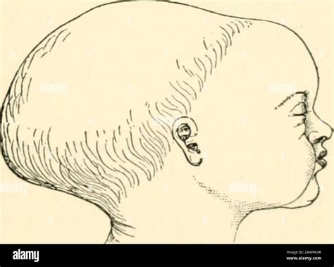 Face Presentation Birth