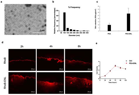 Palmitoylethanolamide-Incorporated Elastic Nano-Liposomes for Enhanced ...