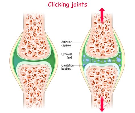 What Happens When You Crack Your Knuckles? - Illuminating Facts