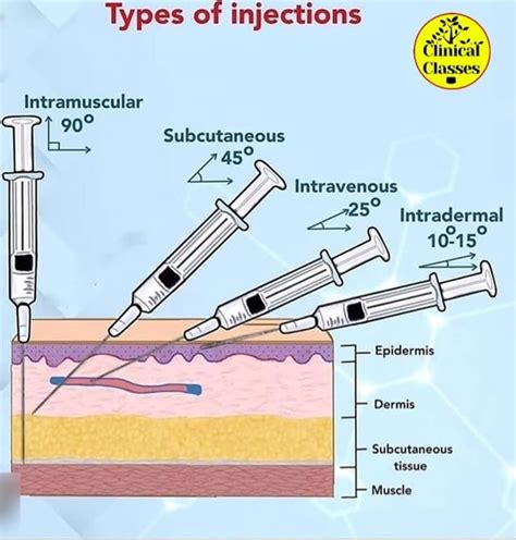 Image result for All Types of Injection