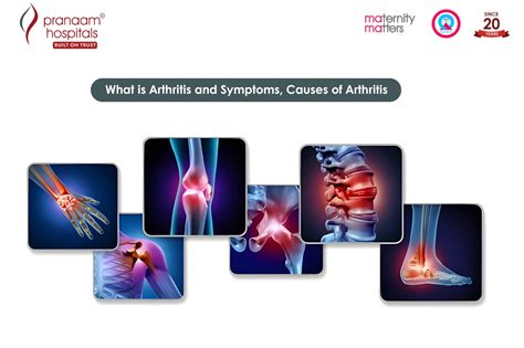 What is Arthritis and Symptoms, Causes of Arthritis - Pranaam Hospitals
