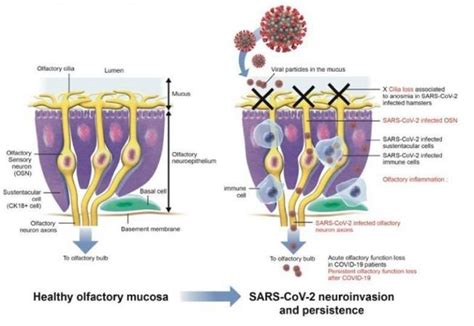Mechanisms of Anosmia Caused By COVID-19 discovered - IBTimes India
