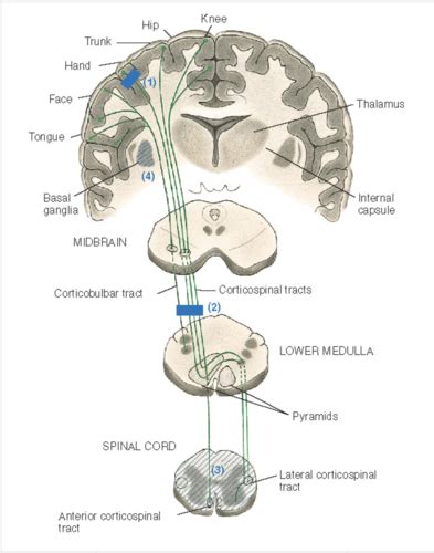 Image result for Contralateral Weakness