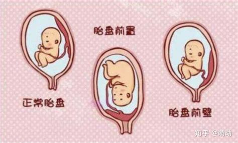 孕20周胎儿大小标准图,孕20周胎儿小鸡彩超图 - 伤感说说吧