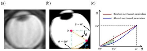 Numerical Investigation on the Role of Mechanical Factors Contributing ...