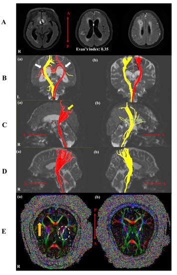 Brain Sciences | Special Issue : Experimental and Clinical Treatment of ...