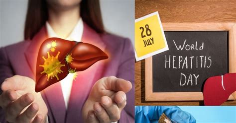 World Hepatitis Day 2025: ਕਿਉਂ ਮਨਾਇਆ ਜਾਂਦਾ ਹੈ ਵਿਸ਼ਵ ਹੈਪੇਟਾਈਟਸ ਦਿਵਸ? ਕੀ ...