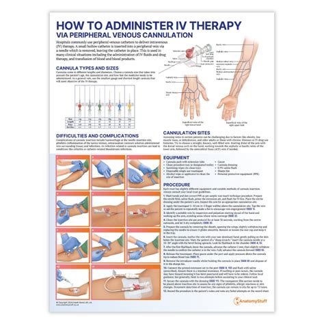 How to Administer IV Therapy Poster | Guide to Intravenous Therapy ...