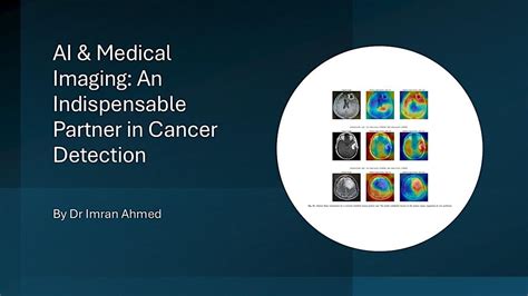 AI & Medical Imaging: An Indispensable Partner in Cancer Detection, CM1 ...