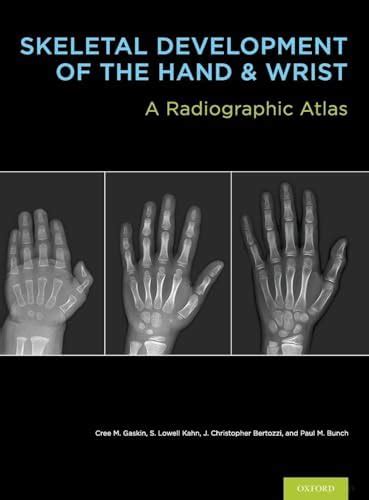 Buy Skeletal Development of the Hand and Wrist: A Radiographic Atlas ...
