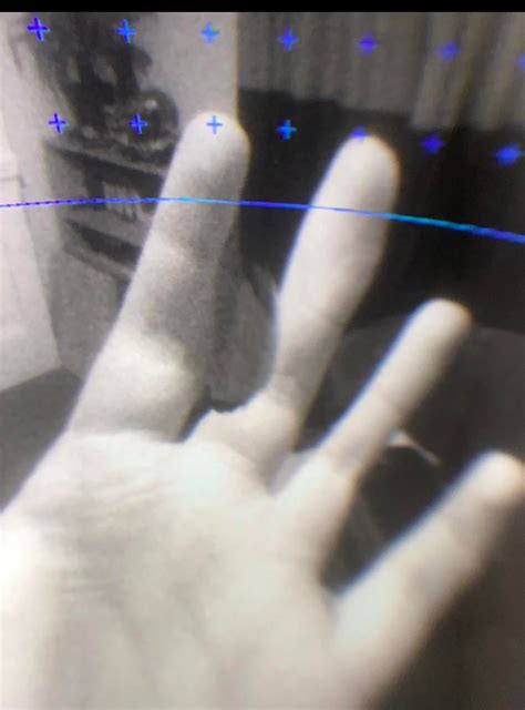 Image result for Camera Issue