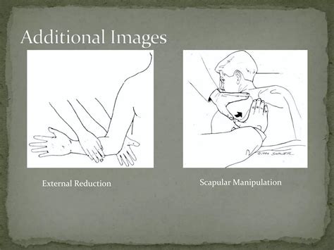 Anterior Shoulder Dislocation | PPTX