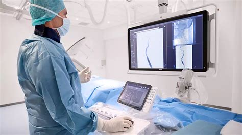 Philips - SmartCT Roadmap - Live 3D image guidance tool