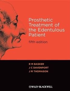 Prosthetic Treatment of the Edentulous Patient: Buy Prosthetic ...