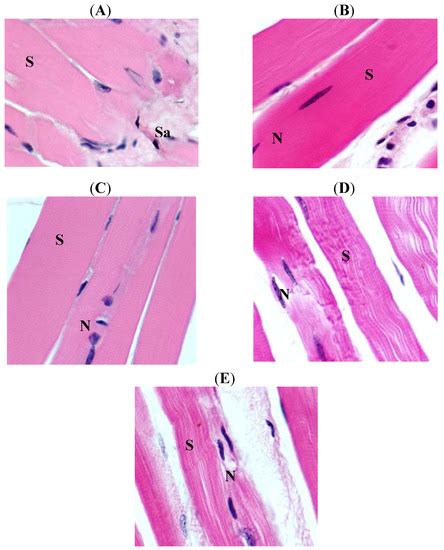 Effects of Vitamin D Treatment on Skeletal Muscle Histology and ...