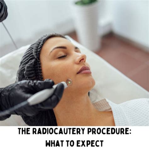 How to Remove Skin Tags with Radiocautery: A Complete Guide | Clinikally
