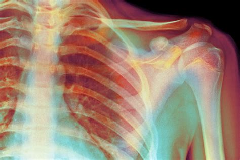 Image result for Skeletal Structural System