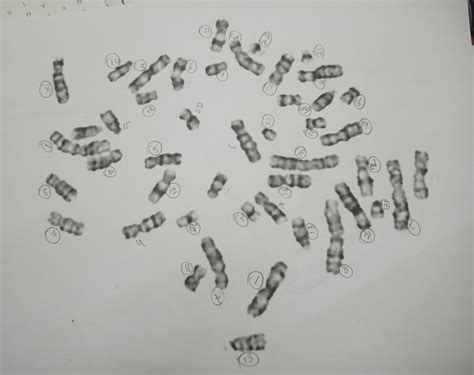 I need the labelling for the karyotype - Brainly.in