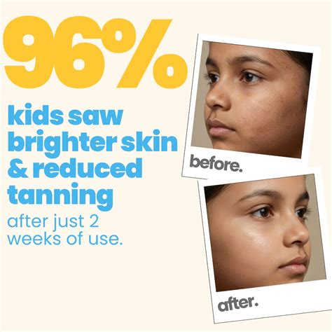 Kids 3-in-1 Dull Skin Kit – Natural Body Care | Tuco Kids