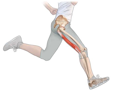 Hamstring Injuries | Biceps Femoris | Semitendinosus | Semimembranosus