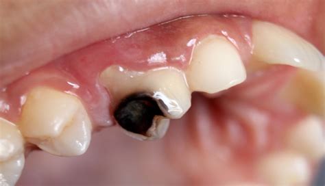 10 Side Effects of Eating Excessive Raisins - lifeberrys.com