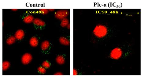 Antibacterial and Anticancer Activities of Pleurocidin-Amide, a Potent ...