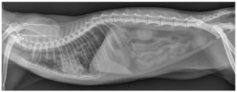 Fulminant Pneumonia Due to Reactivation of Latent Toxoplasmosis in a ...