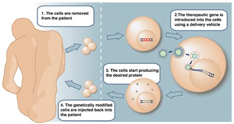 Basic Process of Gene Therapy 的图像结果