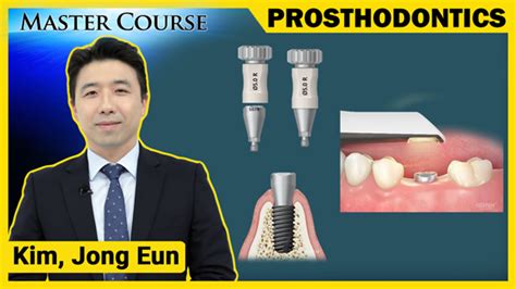 DENALL | Osstem Implant's dental clinical streaming service