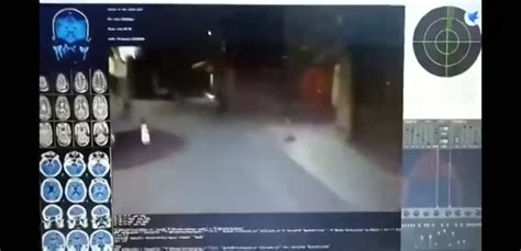 Image result for Remote Neural Monitoring Technology