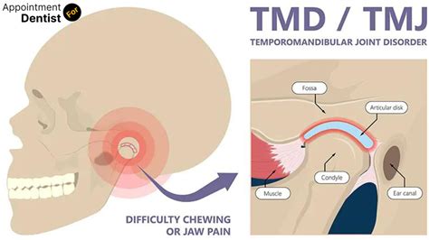 What You Need to Know About Temporomandibular Joint Disorder (TMJ): Symptoms, Causes, and Treatments