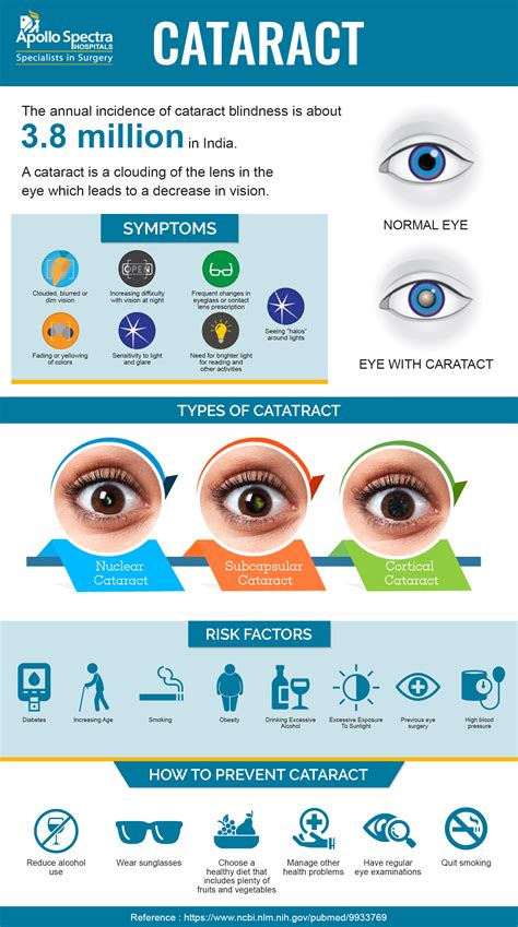 Foods to Prevent Cataracts: Nutrients for Eye Health