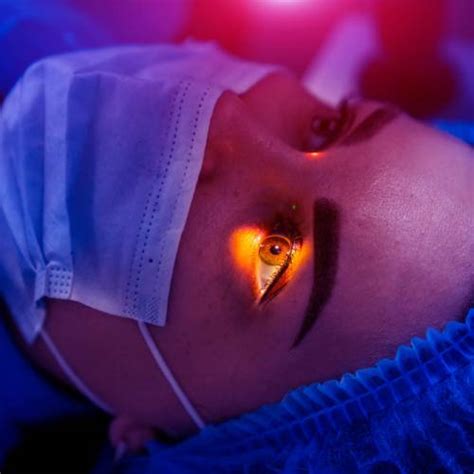 SMILE Laser Eye Surgery - Minimally Invasive Vision Correction at ...