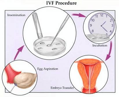 Best IVF Clinic & Hospital in Mumbai | Top Doctors @ Top IVF Centre in ...