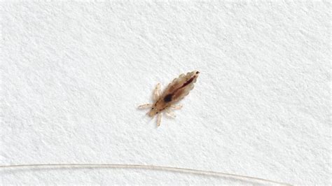 What Causes Lice Infestation? | All You Need to Know! - Pest Samurai