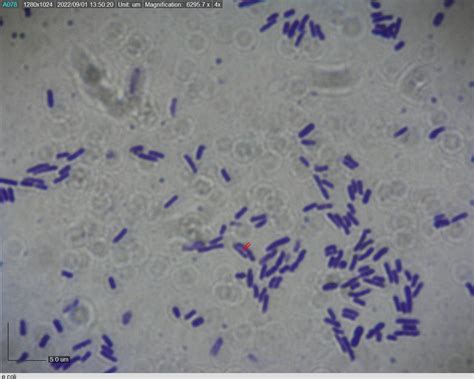 Escherichia Coli Gram Stain