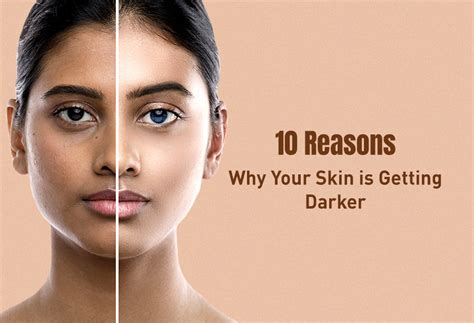 10 Reasons Why Your Skin is Getting Darker Day by Day – skeyndor