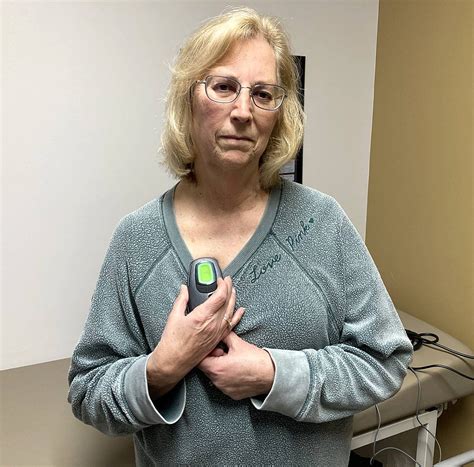 Erie-area woman beats sleep apnea with implantable inspire device