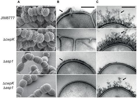Streptococcus Salivarius Agar