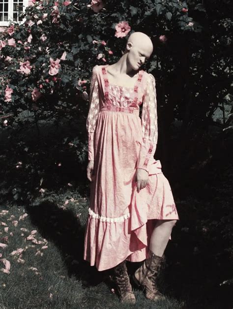 6 Potret Melanie Gaydos, Model Sukses yang Idap Kelainan Genetik