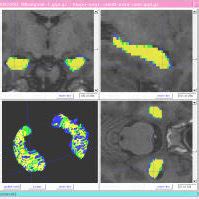 Image result for Inter-Rater Reliability Qualitative Coding