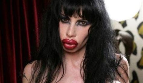 Plastic Surgery Disasters 的图像结果