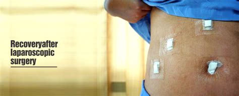 Laparoscopic Surgery – What is it? - Healing Hospital